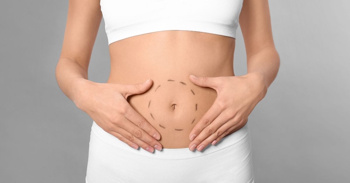 Istanbul Tummy Tuck Surgery
